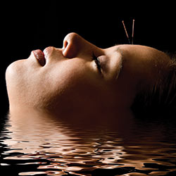 acupuncture-head